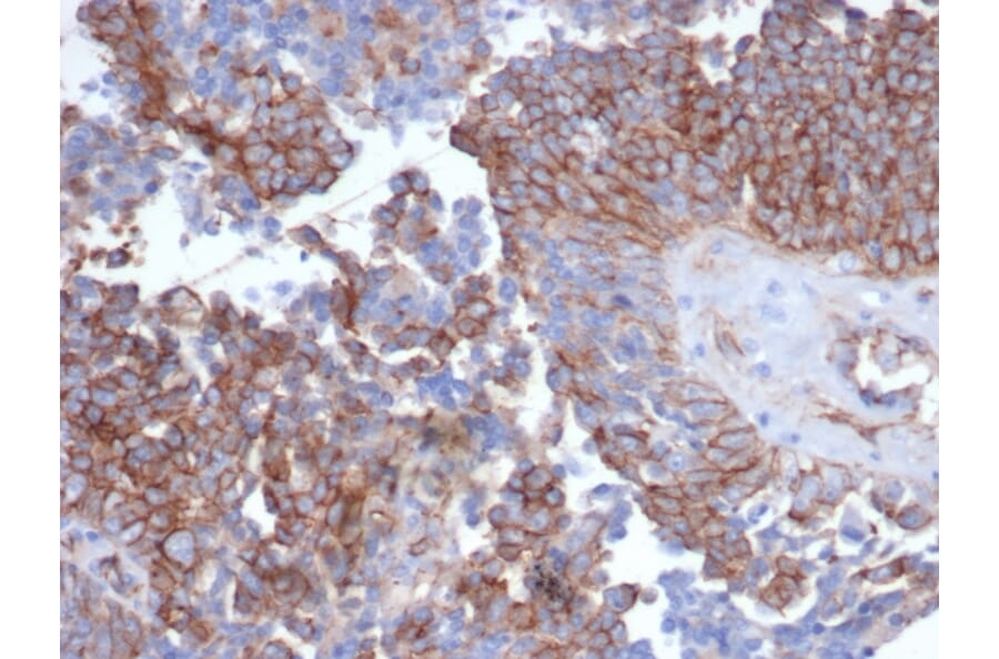 Immunohistochemistry - Anti-N Cadherin Antibody [CDH2/6857R] - BSA and Azide free (A278534) - Antibodies.com
