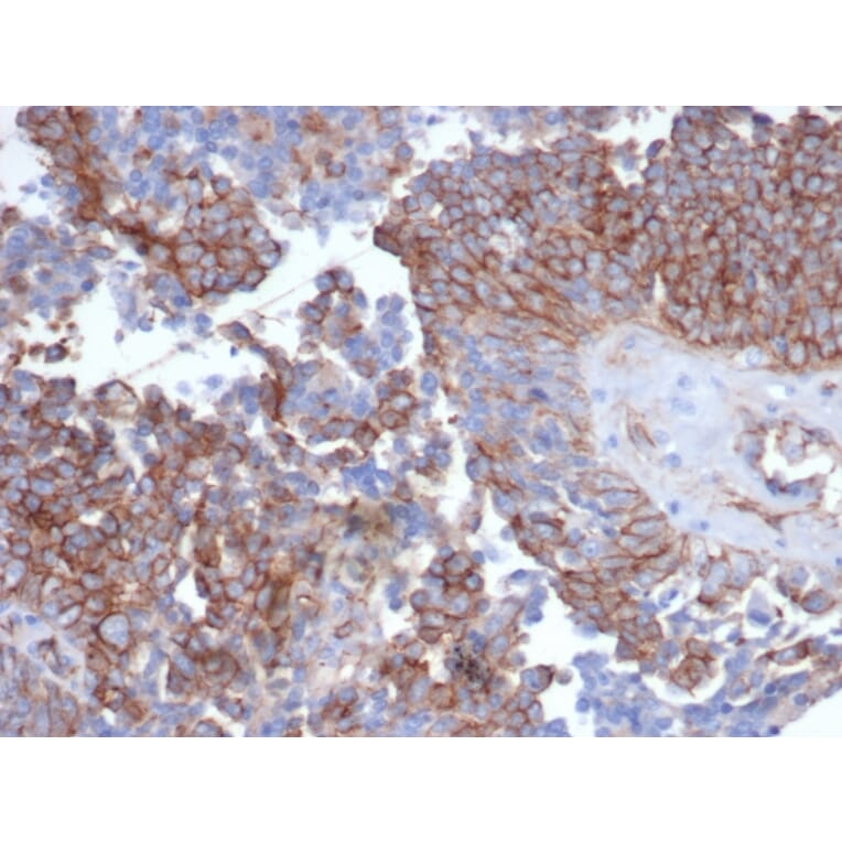 Immunohistochemistry - Anti-N Cadherin Antibody [CDH2/6857R] - BSA and Azide free (A278534) - Antibodies.com