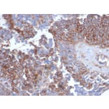 Immunohistochemistry - Anti-N Cadherin Antibody [CDH2/6857R] - BSA and Azide free (A278534) - Antibodies.com