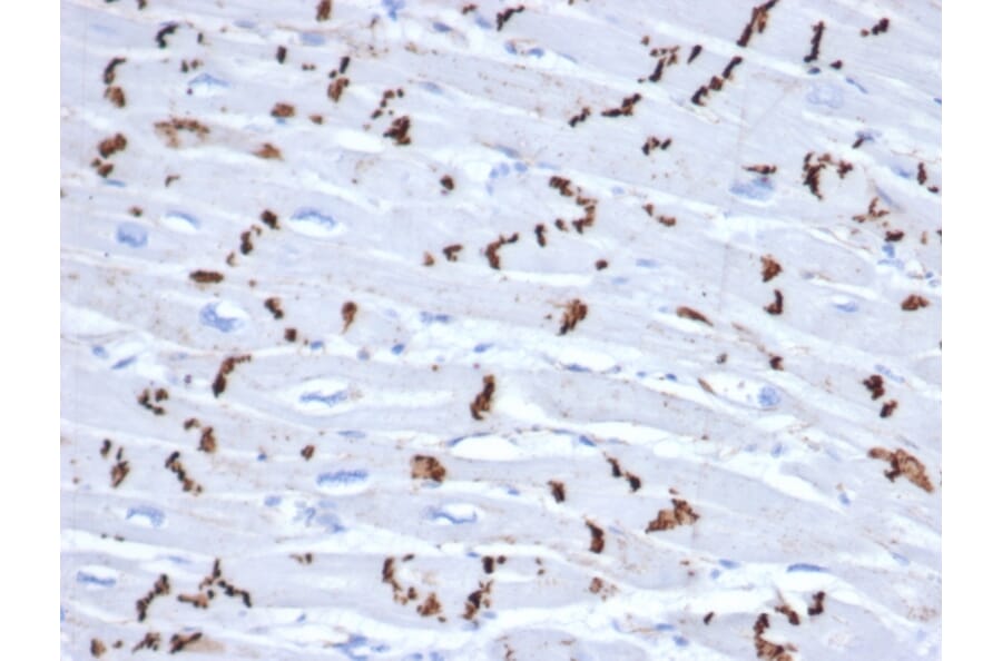 Immunohistochemistry - Anti-N Cadherin Antibody [CDH2/6857R] - BSA and Azide free (A278534) - Antibodies.com