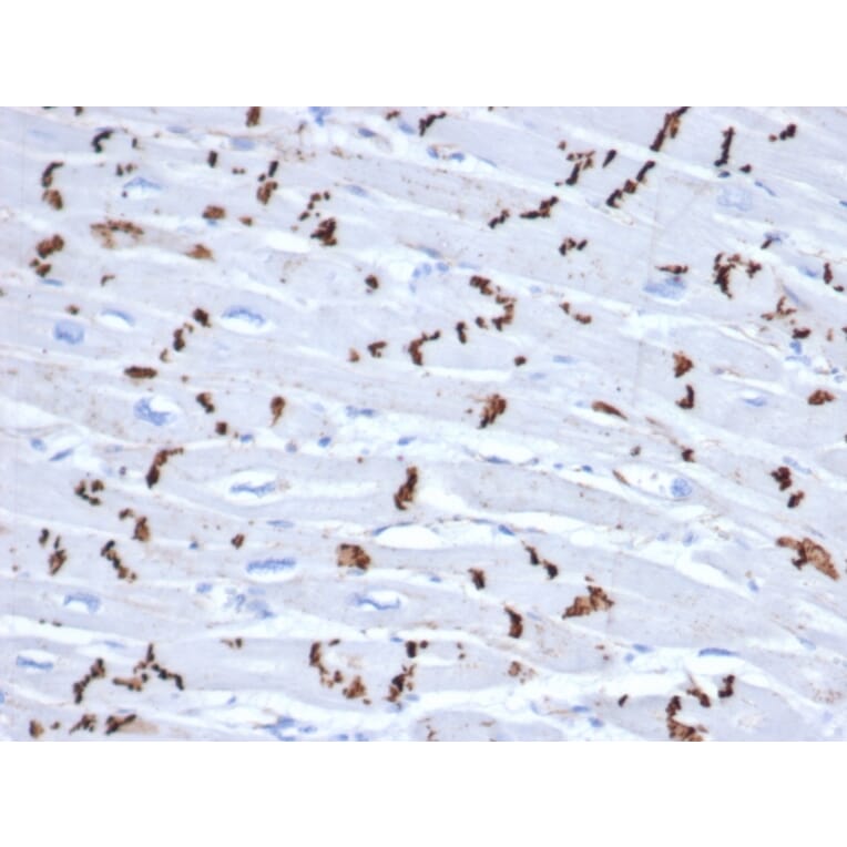 Immunohistochemistry - Anti-N Cadherin Antibody [CDH2/6857R] - BSA and Azide free (A278534) - Antibodies.com