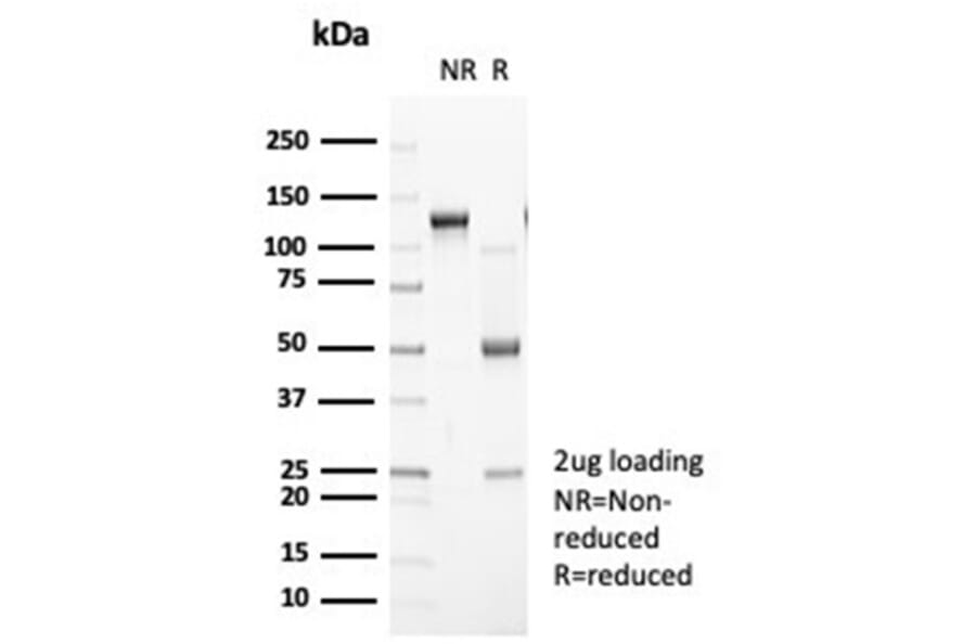 SDS-PAGE - Anti-N Cadherin Antibody [CDH2/7070R] - BSA and Azide free (A278535) - Antibodies.com