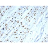 Immunohistochemistry - Anti-N Cadherin Antibody [CDH2/7070R] - BSA and Azide free (A278535) - Antibodies.com