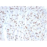 Immunohistochemistry - Anti-N Cadherin Antibody [CDH2/7070R] - BSA and Azide free (A278535) - Antibodies.com