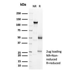 SDS-PAGE - Anti-Cadherin 16 Antibody [CDH16/7027R] - BSA and Azide free (A278536) - Antibodies.com