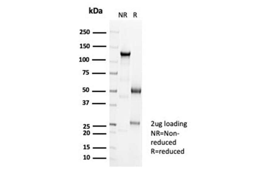 SDS-PAGE - Anti-Cadherin 16 Antibody [CDH16/7027R] - BSA and Azide free (A278536) - Antibodies.com