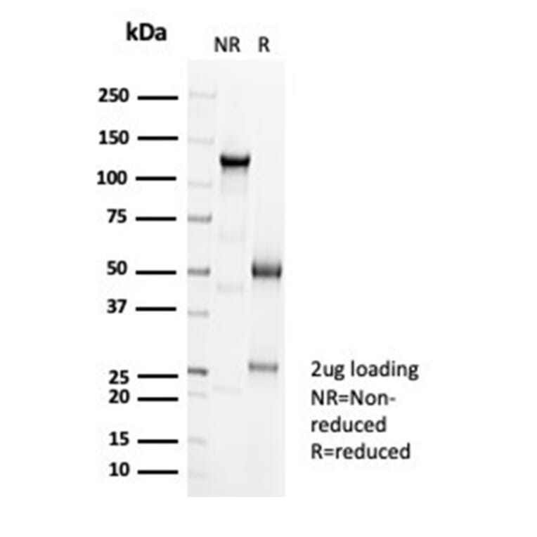 SDS-PAGE - Anti-Cadherin 16 Antibody [CDH16/7027R] - BSA and Azide free (A278536) - Antibodies.com