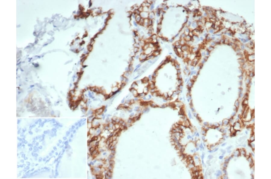 Immunohistochemistry - Anti-Cadherin 16 Antibody [CDH16/7027R] - BSA and Azide free (A278536) - Antibodies.com