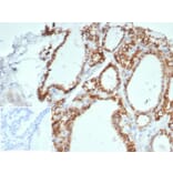 Immunohistochemistry - Anti-Cadherin 16 Antibody [CDH16/7027R] - BSA and Azide free (A278536) - Antibodies.com