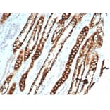 Immunohistochemistry - Anti-Cadherin 16 Antibody [CDH16/7027R] - BSA and Azide free (A278536) - Antibodies.com