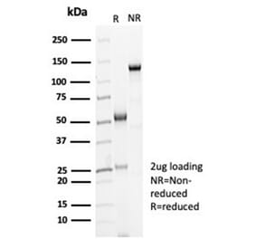 SDS-PAGE - Anti-Cadherin 16 Antibody [CDH16/7028R] - BSA and Azide free (A278537) - Antibodies.com