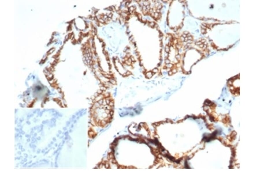 Immunohistochemistry - Anti-Cadherin 16 Antibody [CDH16/7028R] - BSA and Azide free (A278537) - Antibodies.com