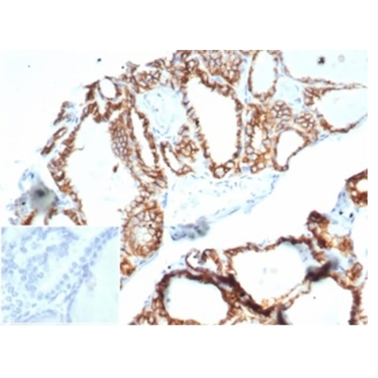 Immunohistochemistry - Anti-Cadherin 16 Antibody [CDH16/7028R] - BSA and Azide free (A278537) - Antibodies.com
