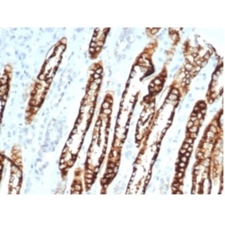 Immunohistochemistry - Anti-Cadherin 16 Antibody [CDH16/7028R] - BSA and Azide free (A278537) - Antibodies.com