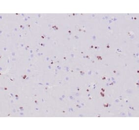 Immunohistochemistry - Anti-OLIG2 Antibody [OLIG2/6695R] - BSA and Azide free (A278538) - Antibodies.com