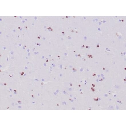 Immunohistochemistry - Anti-OLIG2 Antibody [OLIG2/6695R] - BSA and Azide free (A278538) - Antibodies.com