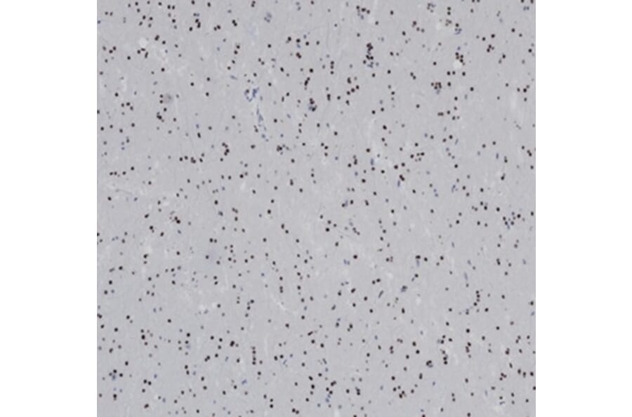Immunohistochemistry - Anti-OLIG2 Antibody [OLIG2/6695R] - BSA and Azide free (A278538) - Antibodies.com