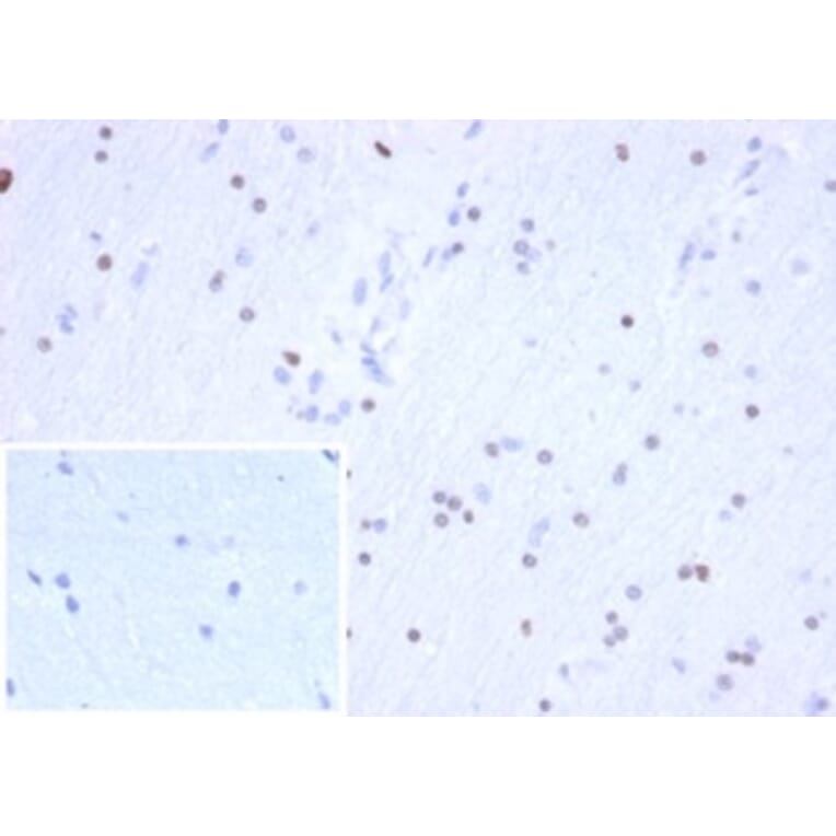 Immunohistochemistry - Anti-OLIG2 Antibody [OLIG2/6695R] - BSA and Azide free (A278538) - Antibodies.com