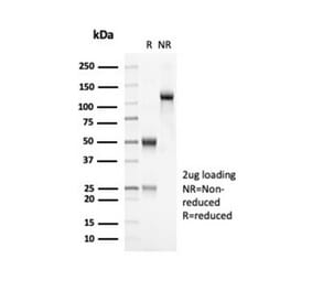 SDS-PAGE - Anti-OLIG2 Antibody [OLIG2/7074R] - BSA and Azide free (A278539) - Antibodies.com