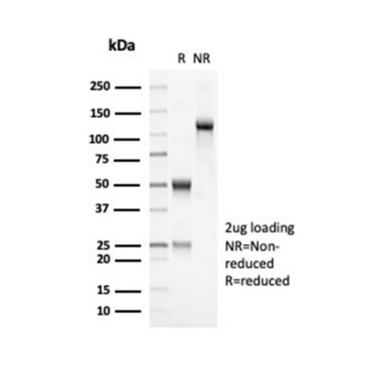 SDS-PAGE - Anti-OLIG2 Antibody [OLIG2/7074R] - BSA and Azide free (A278539) - Antibodies.com