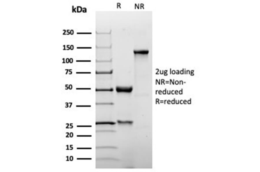 SDS-PAGE - Anti-p27 Kip1 Antibody [KIP1/1355R] - BSA and Azide free (A278540) - Antibodies.com