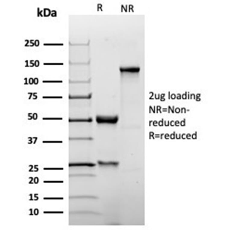 SDS-PAGE - Anti-p27 Kip1 Antibody [KIP1/1355R] - BSA and Azide free (A278540) - Antibodies.com