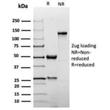 SDS-PAGE - Anti-p27 Kip1 Antibody [KIP1/1355R] - BSA and Azide free (A278540) - Antibodies.com