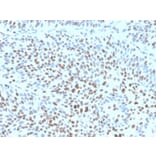 Immunohistochemistry - Anti-p27 Kip1 Antibody [KIP1/1355R] - BSA and Azide free (A278540) - Antibodies.com