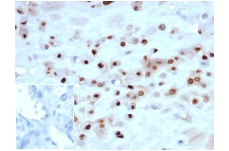 Immunohistochemistry - Anti-p57 Kip2 Antibody [KIP2/7083R] - BSA and Azide free (A278541) - Antibodies.com
