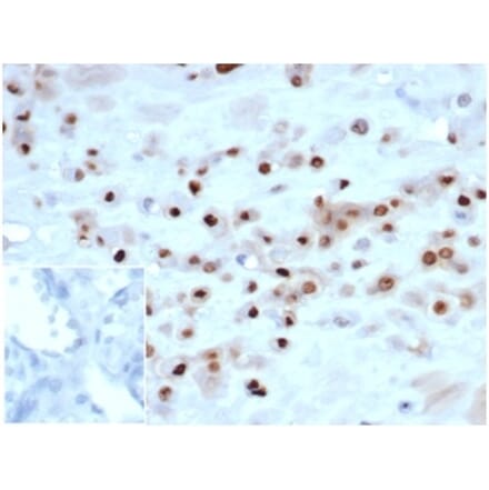 Immunohistochemistry - Anti-p57 Kip2 Antibody [KIP2/7083R] - BSA and Azide free (A278541) - Antibodies.com