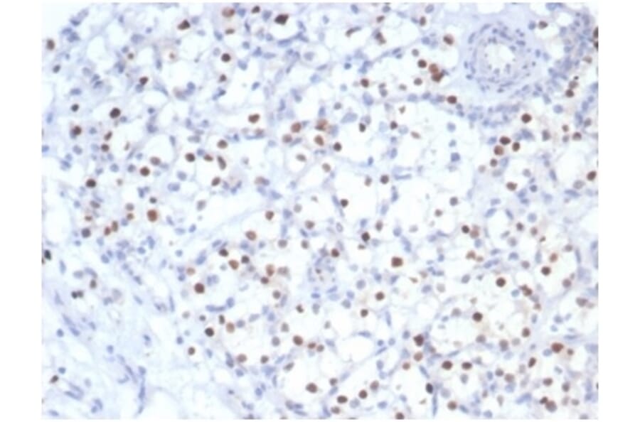 Immunohistochemistry - Anti-p57 Kip2 Antibody [KIP2/7083R] - BSA and Azide free (A278541) - Antibodies.com