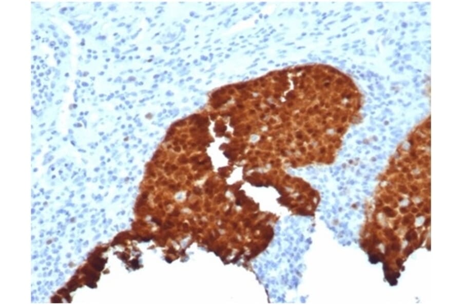 Immunohistochemistry - Anti-p16INK4a Antibody [CDKN2A/4844R] - BSA and Azide free (A278542) - Antibodies.com