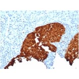 Immunohistochemistry - Anti-p16INK4a Antibody [CDKN2A/4844R] - BSA and Azide free (A278542) - Antibodies.com