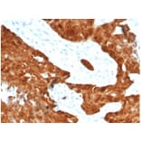 Immunohistochemistry - Anti-p16INK4a Antibody [CDKN2A/7081R] - BSA and Azide free (A278543) - Antibodies.com
