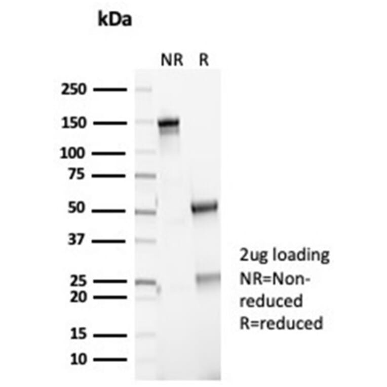 SDS-PAGE - Anti-p16INK4a Antibody [CDKN2A/7081R] - BSA and Azide free (A278543) - Antibodies.com