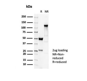 SDS-PAGE - Anti-beta III Tubulin Antibody [TUBB3/7089R] - BSA and Azide free (A278544) - Antibodies.com