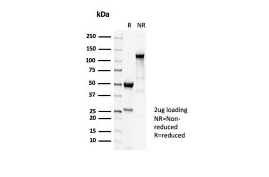 SDS-PAGE - Anti-beta III Tubulin Antibody [TUBB3/7089R] - BSA and Azide free (A278544) - Antibodies.com