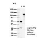 SDS-PAGE - Anti-beta III Tubulin Antibody [TUBB3/7089R] - BSA and Azide free (A278544) - Antibodies.com