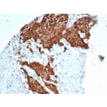 Immunohistochemistry - Anti-beta III Tubulin Antibody [TUBB3/7089R] - BSA and Azide free (A278544) - Antibodies.com