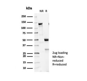 SDS-PAGE - Anti-beta III Tubulin Antibody [TUBB3/7090R] - BSA and Azide free (A278545) - Antibodies.com