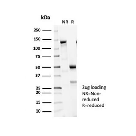 SDS-PAGE - Anti-beta III Tubulin Antibody [TUBB3/7090R] - BSA and Azide free (A278545) - Antibodies.com