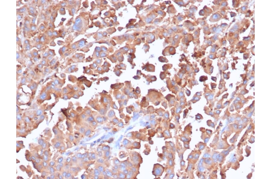 Immunohistochemistry - Anti-Carcinoembryonic Antigen Antibody [C66/6470R] - BSA and Azide free (A278546) - Antibodies.com