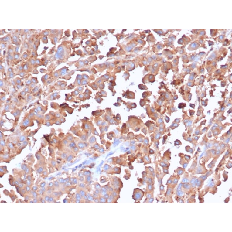 Immunohistochemistry - Anti-Carcinoembryonic Antigen Antibody [C66/6470R] - BSA and Azide free (A278546) - Antibodies.com