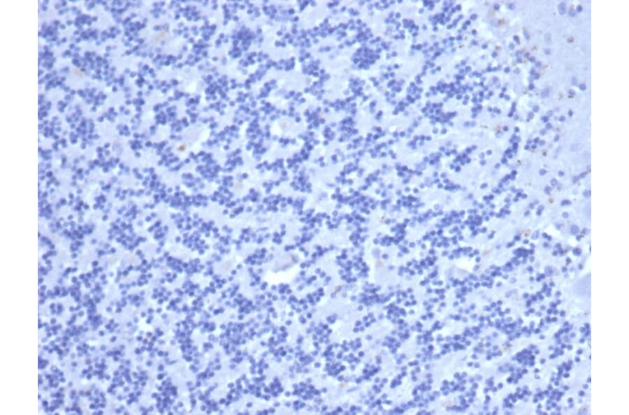 Immunohistochemistry - Anti-Carcinoembryonic Antigen Antibody [C66/6470R] - BSA and Azide free (A278546) - Antibodies.com