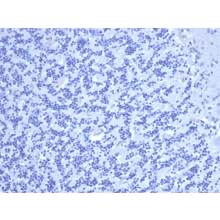 Immunohistochemistry - Anti-Carcinoembryonic Antigen Antibody [C66/6470R] - BSA and Azide free (A278546) - Antibodies.com