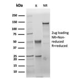 SDS-PAGE - Anti-Carcinoembryonic Antigen Antibody [C66/6470R] - BSA and Azide free (A278546) - Antibodies.com