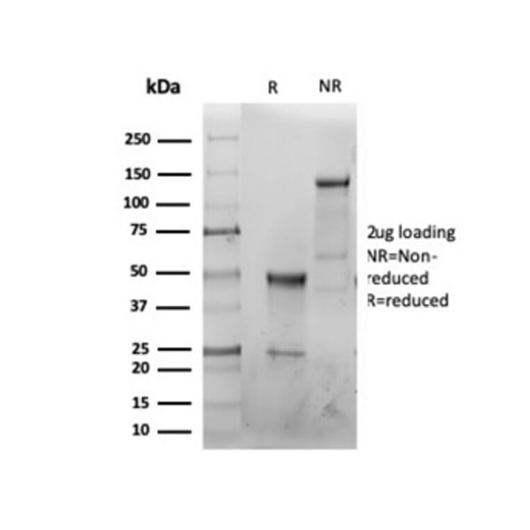 SDS-PAGE - Anti-CFTR Antibody [CFTR/6477R] - BSA and Azide free (A278547) - Antibodies.com