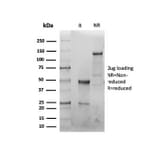 SDS-PAGE - Anti-CFTR Antibody [CFTR/6477R] - BSA and Azide free (A278547) - Antibodies.com