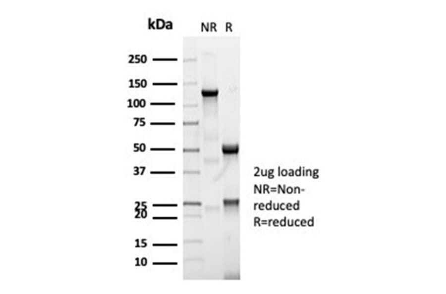 SDS-PAGE - Anti-CFTR Antibody [CFTR/7003R] - BSA and Azide free (A278548) - Antibodies.com