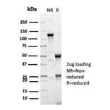 SDS-PAGE - Anti-CFTR Antibody [CFTR/7003R] - BSA and Azide free (A278548) - Antibodies.com